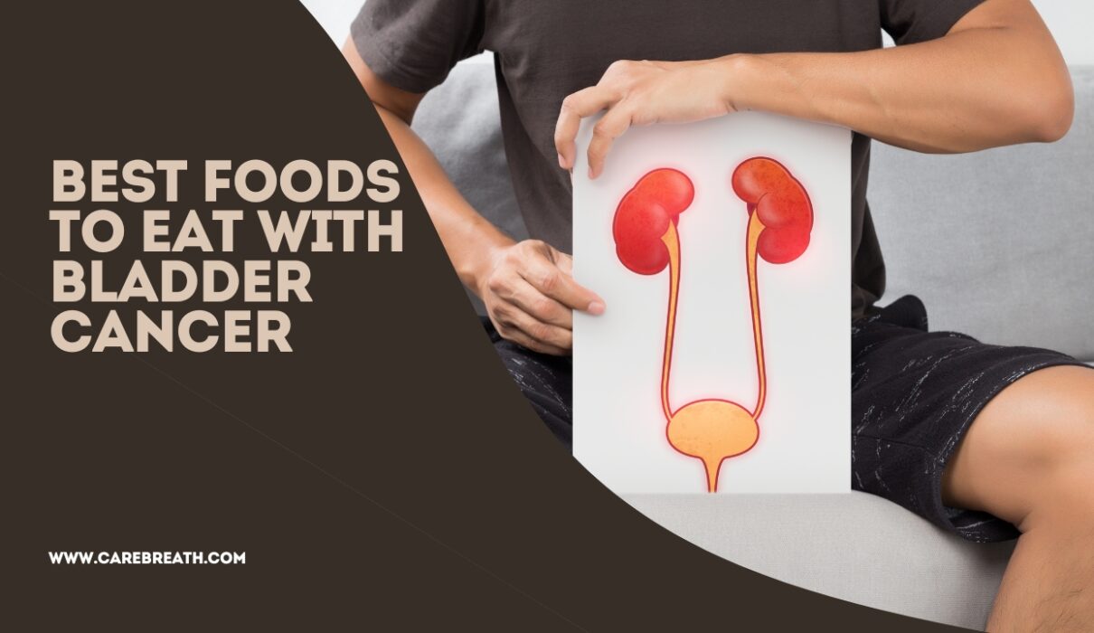 Best Foods to Eat with Bladder Cancer