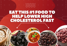 Cholesterol