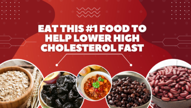 Cholesterol